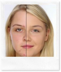 Проблемная кожа