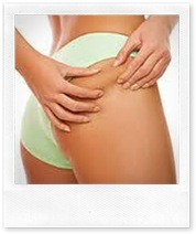 Первые признаки целлюлита