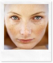 Пигментные пятна на коже