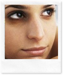 Темные круги под глазами