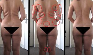 потянуть кожу