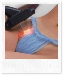 Особенности лазерной эпиляции