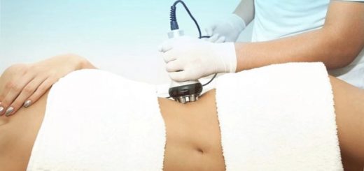 RF-лифтинг тела