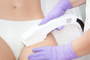 лазерная эпиляция бикини