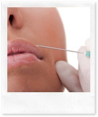 Липофилинг