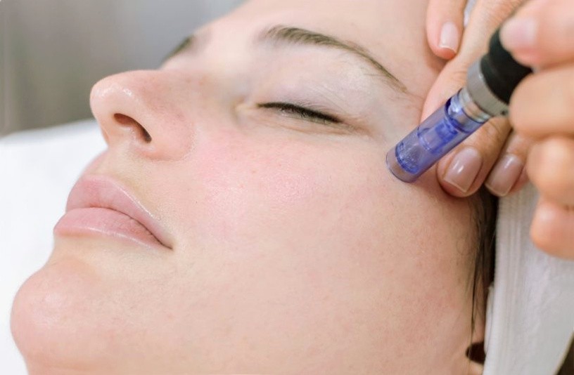 процедура мезотерапии без уколов