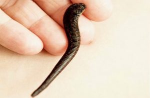 пиявки в косметологии