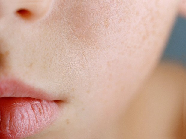 чистая кожа