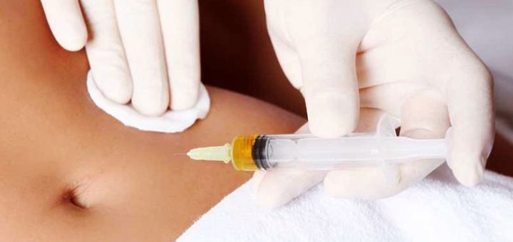 Мезодиссолюция живота