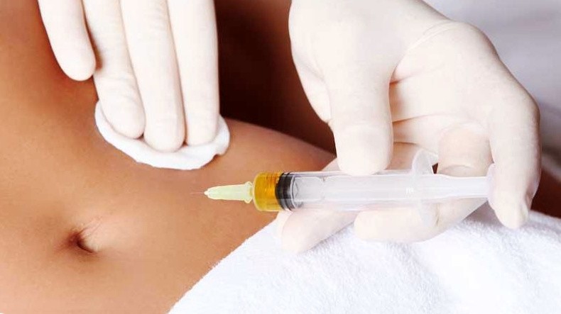 Мезодиссолюция  живота