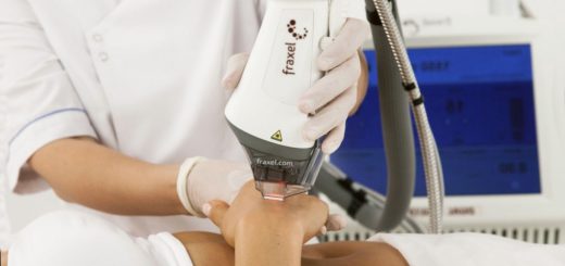 омоложение рук фракселем