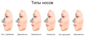 Формы носа