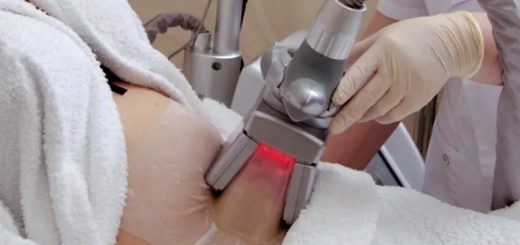 криолиполиз живота