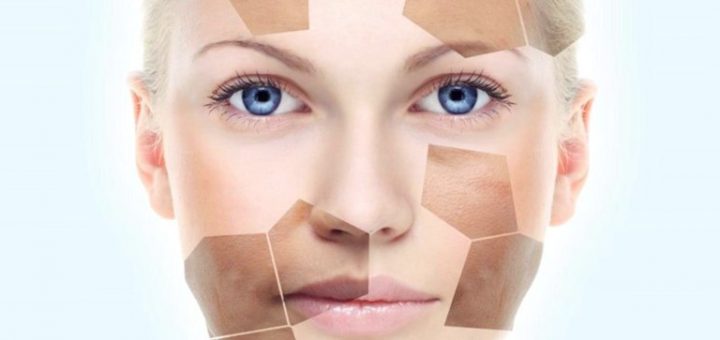 Удаление нежелательной пигментации