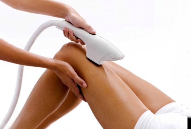 Элос эпиляция