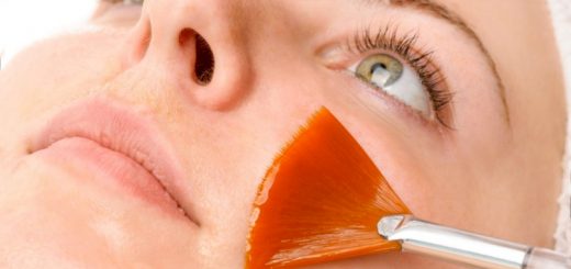 химический пилинг