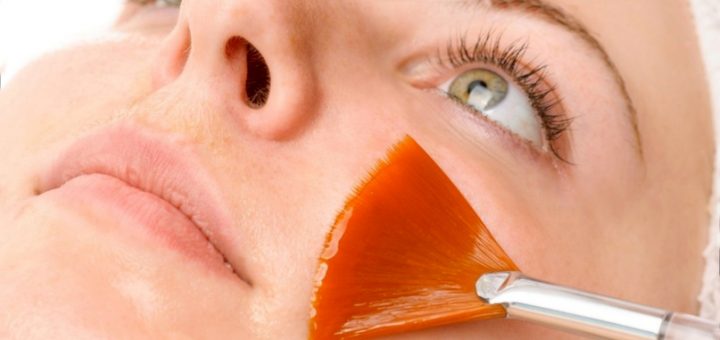 химический пилинг