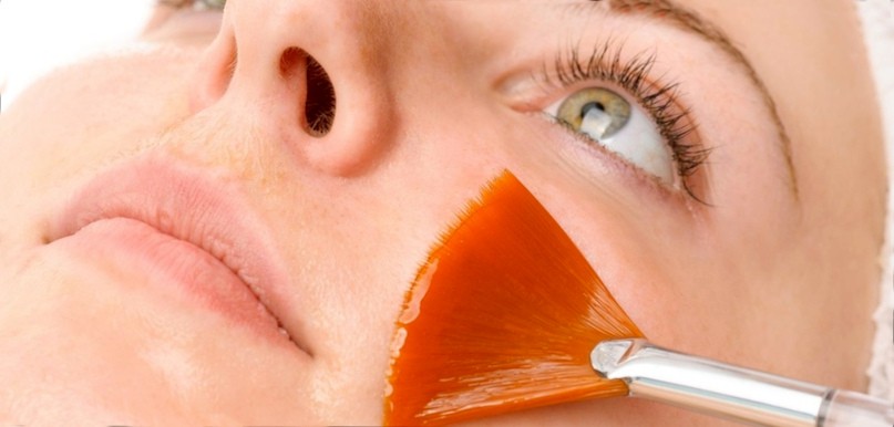 химический пилинг