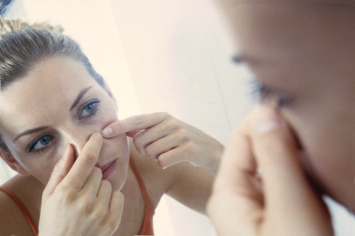 девушка выдавливает прыщи