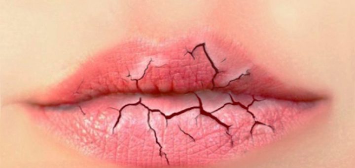 Трещины на губах