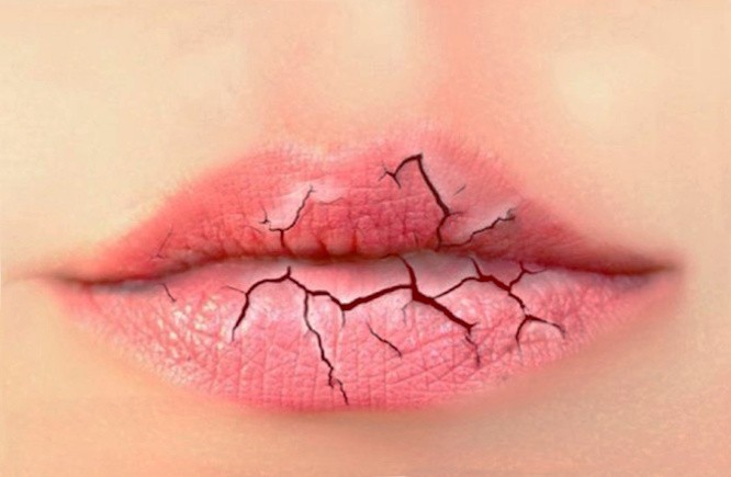 Трещины на губах