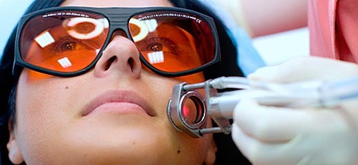 лазерное удаление родинки