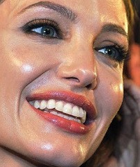 жирный блеск кожи