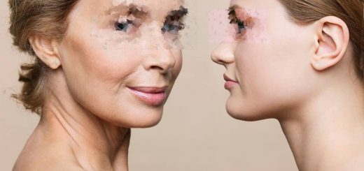 Платизмопластика: кардинальное омоложение шеи