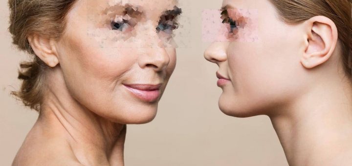 Платизмопластика: кардинальное омоложение шеи