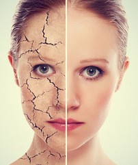 ухаживать за комбинированной кожей