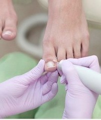 аппаратный уход за ногами