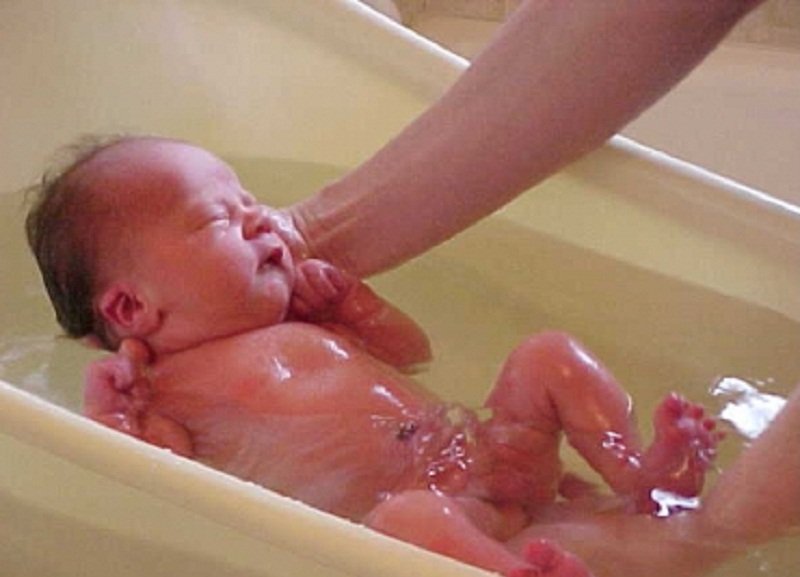 уход за кожей новорожденного