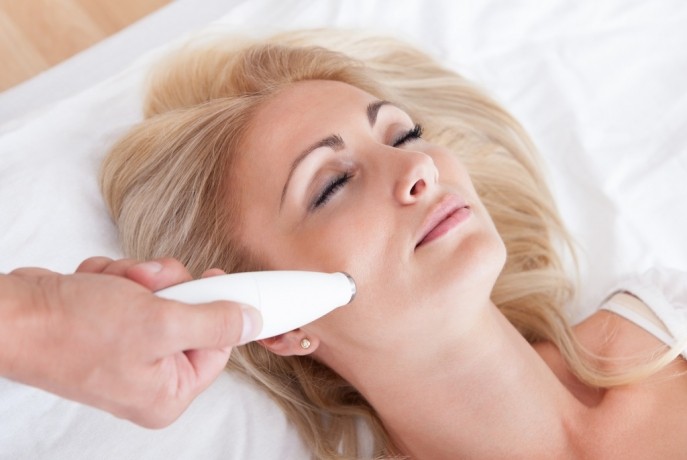 Термолифтинг для омоложения