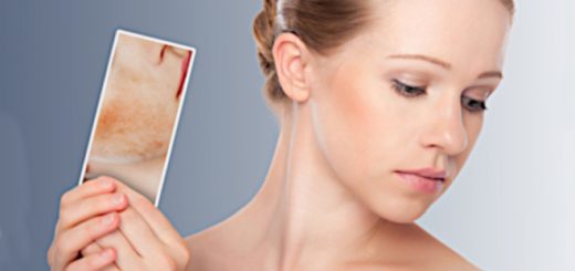 Себорейный дерматит