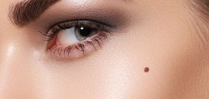 родинка на лице