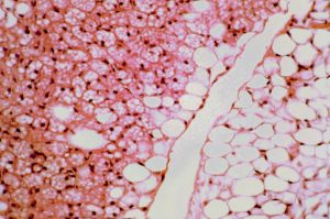 Белая и бурая жировые ткани