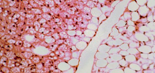 Белая и бурая жировые ткани