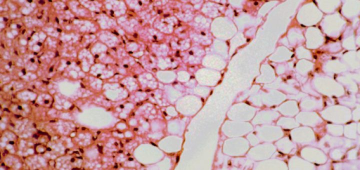 Белая и бурая жировые ткани