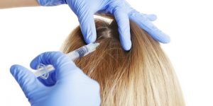 лечении алопеции