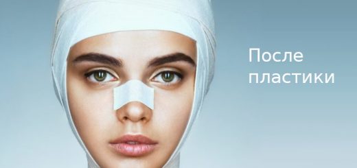 после пластики