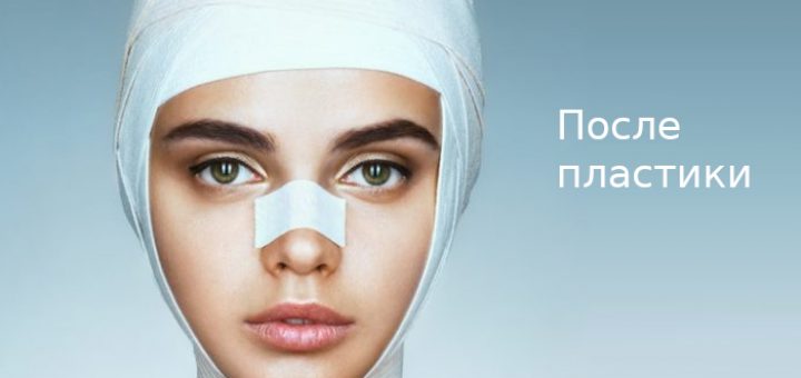 после пластики