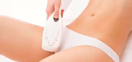 депиляция бикини