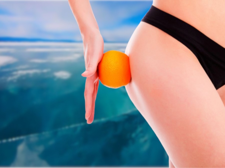 криомассаж от целлюлита