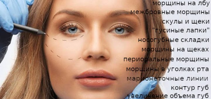 контурная пластика лица