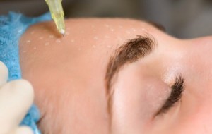 Эффективные методики омоложения безоперационным способом