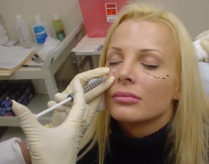 Инъекции sculptra