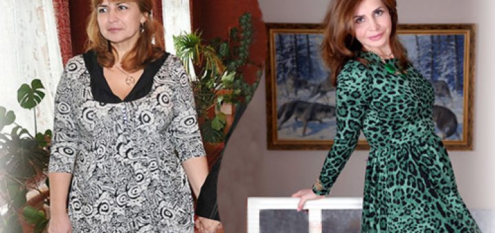 Безоперационная подтяжка