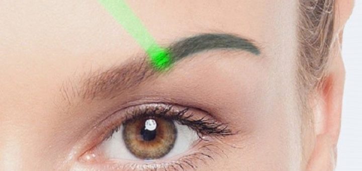 Лазерное удаление татуажа бровей