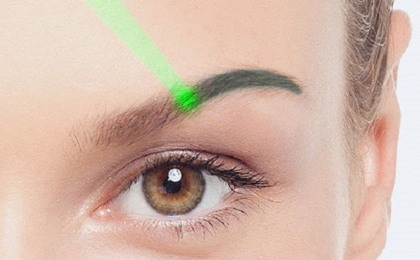 Лазерное удаление татуажа бровей