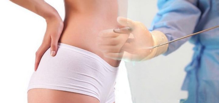 водная липосакция